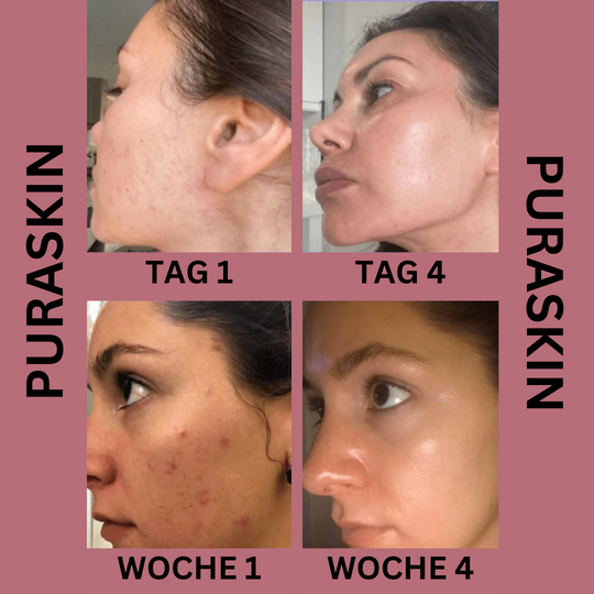 PuraWand Skincare